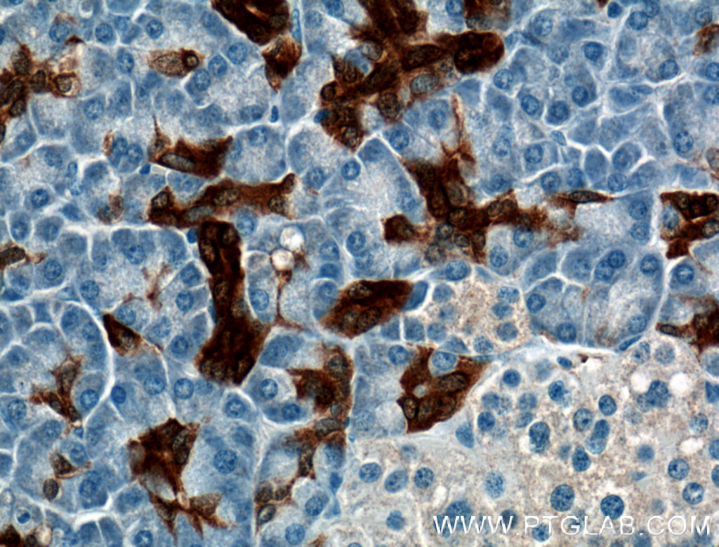 IHC staining of human pancreas using 66405-1-Ig