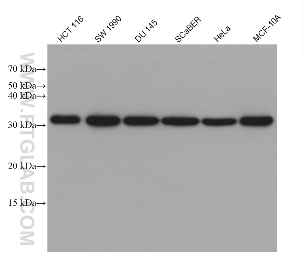 WB analysis using 66405-1-Ig