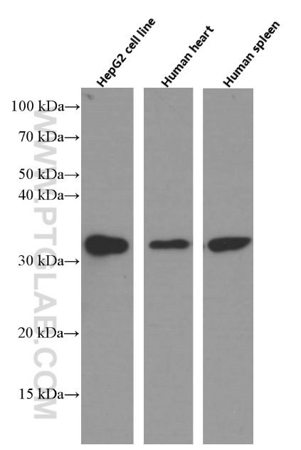 WB analysis using 66405-1-Ig