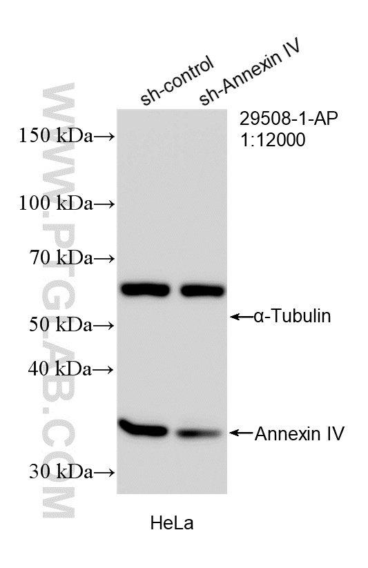 WB analysis of HeLa using 29508-1-AP WB analysis of HeLa using 29508-1-AP