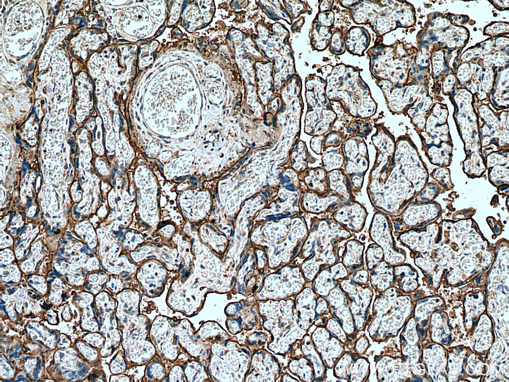 IHC staining of human placenta using 60288-2-Ig (same clone as 60288-2-PBS)