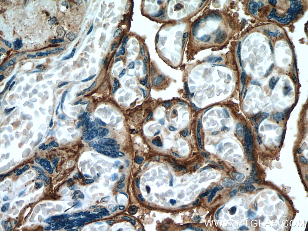 IHC staining of human placenta using 60288-2-Ig (same clone as 60288-2-PBS)