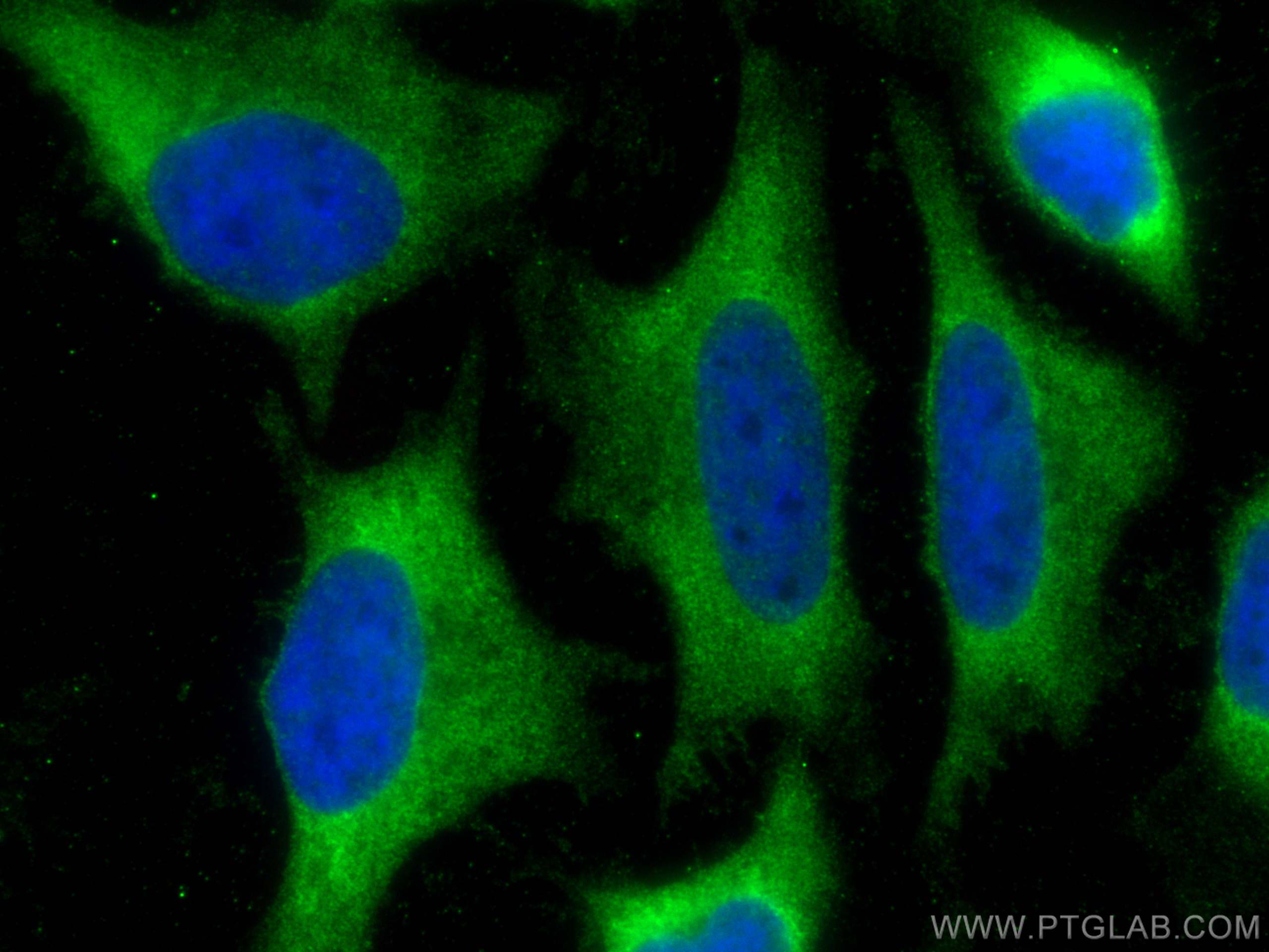 IF Staining of HeLa using 66245-1-Ig (same clone as 66245-1-PBS)