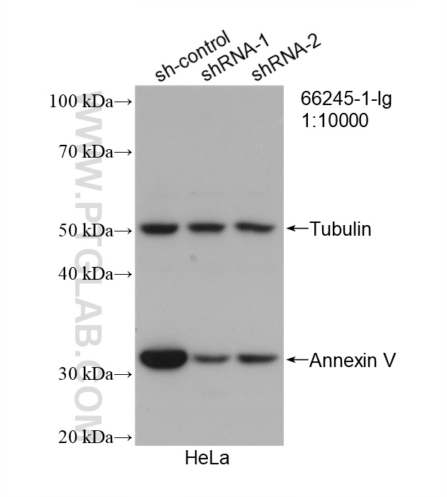 WB analysis of HeLa using 66245-1-Ig (same clone as 66245-1-PBS)