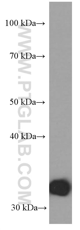 Annexin V Monoclonal antibody