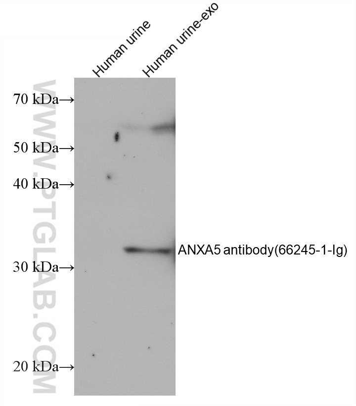 WB analysis using 66245-1-Ig