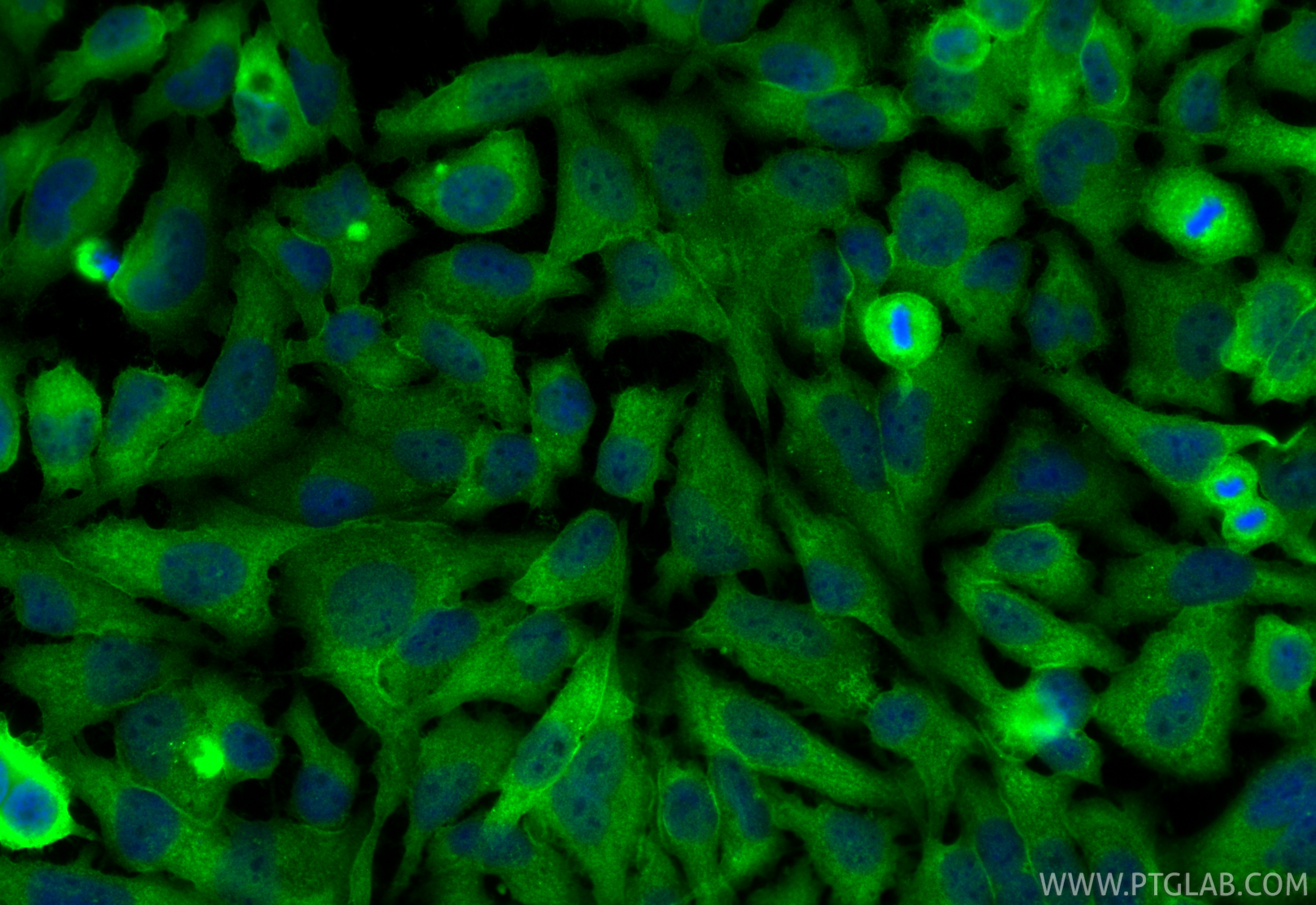 IF Staining of HeLa using RMX00072