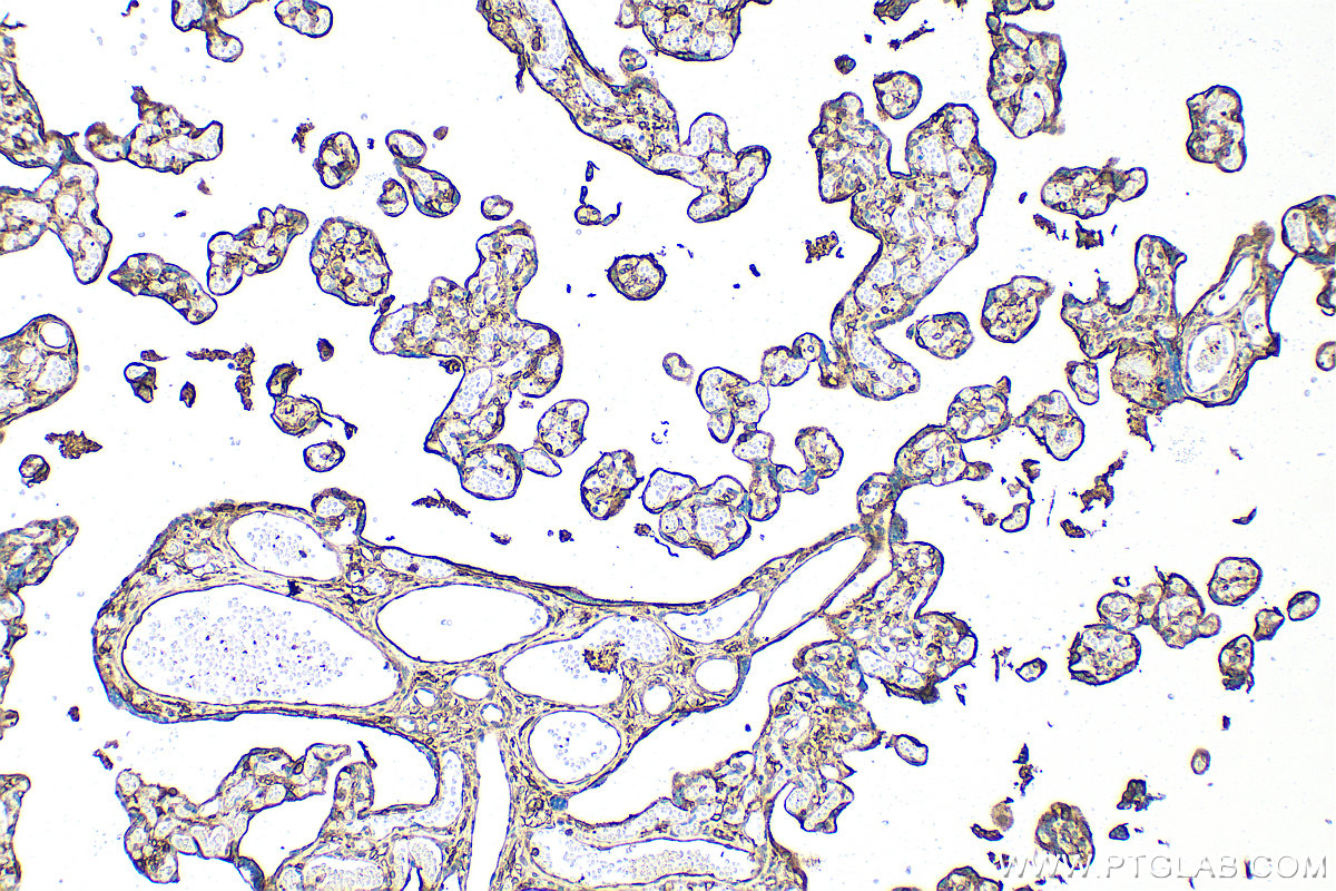 IHC staining of human placenta using RMX00072