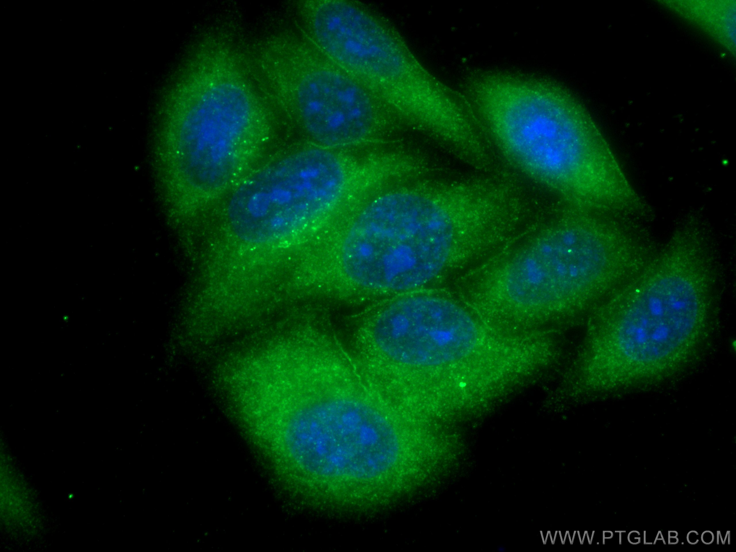 IF Staining of HepG2 using 68086-1-Ig (same clone as 68086-1-PBS)