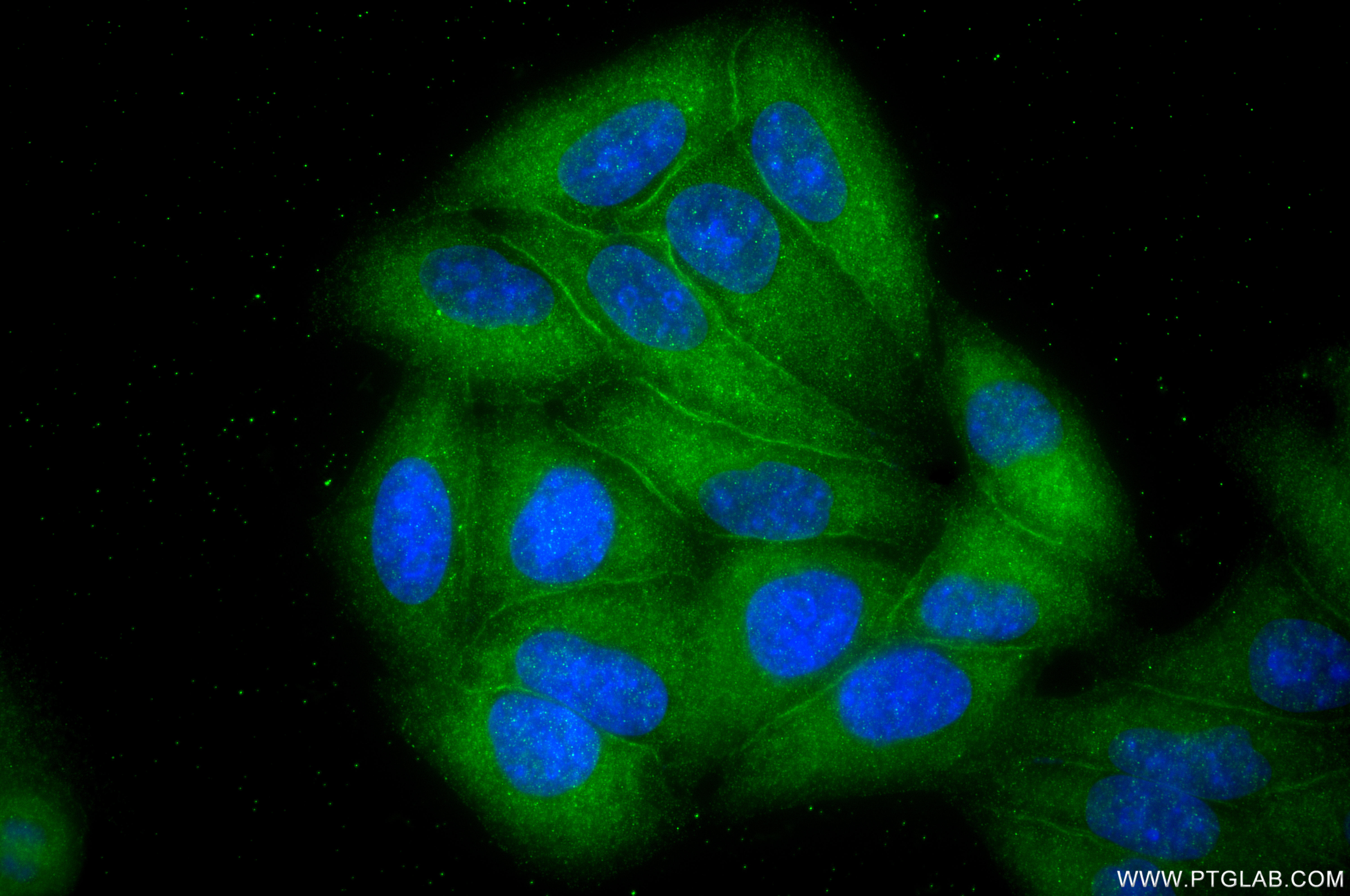 IF Staining of HepG2 using 87752-4-RR (same clone as 87752-4-PBS) IF Staining of HepG2 using 87752-4-RR (same clone as 87752-4-PBS)