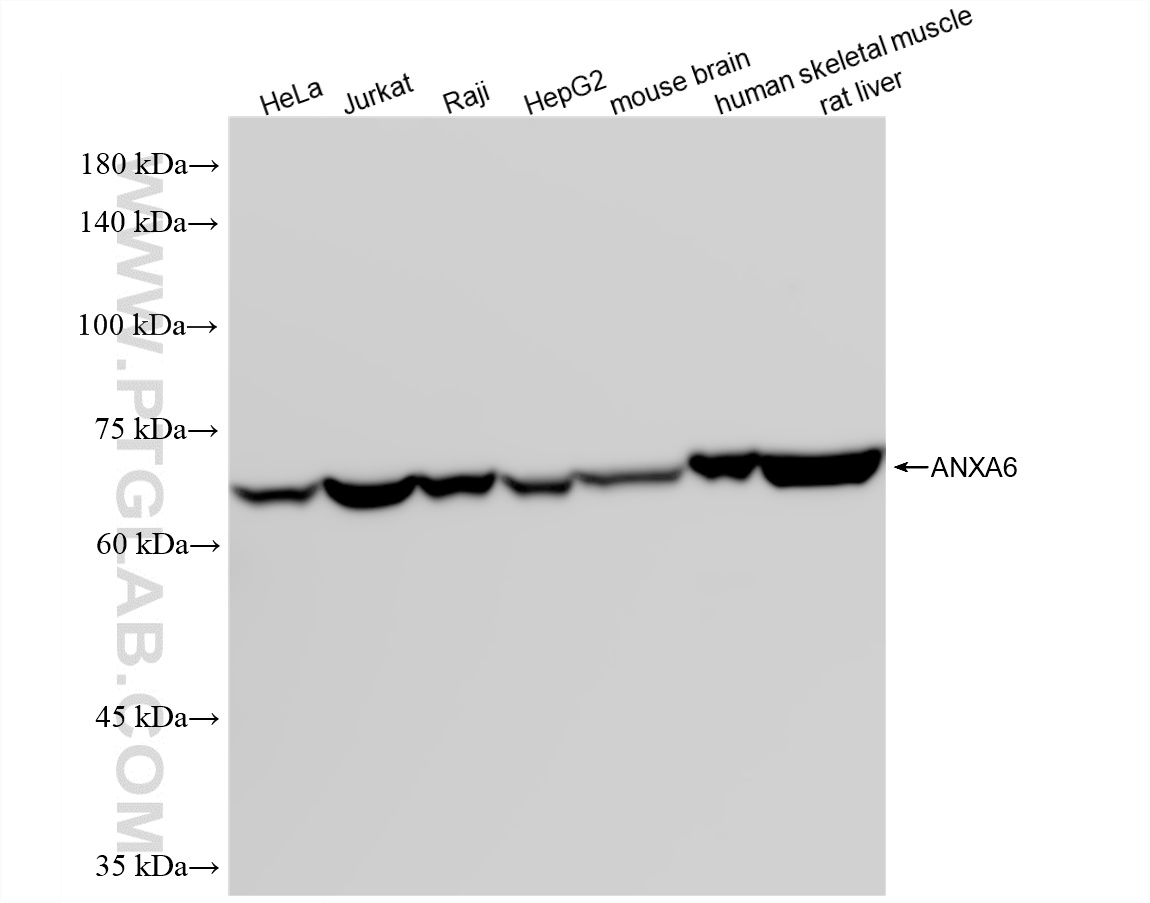 WB analysis using 87752-4-RR (same clone as 87752-4-PBS) WB analysis using 87752-4-RR (same clone as 87752-4-PBS)