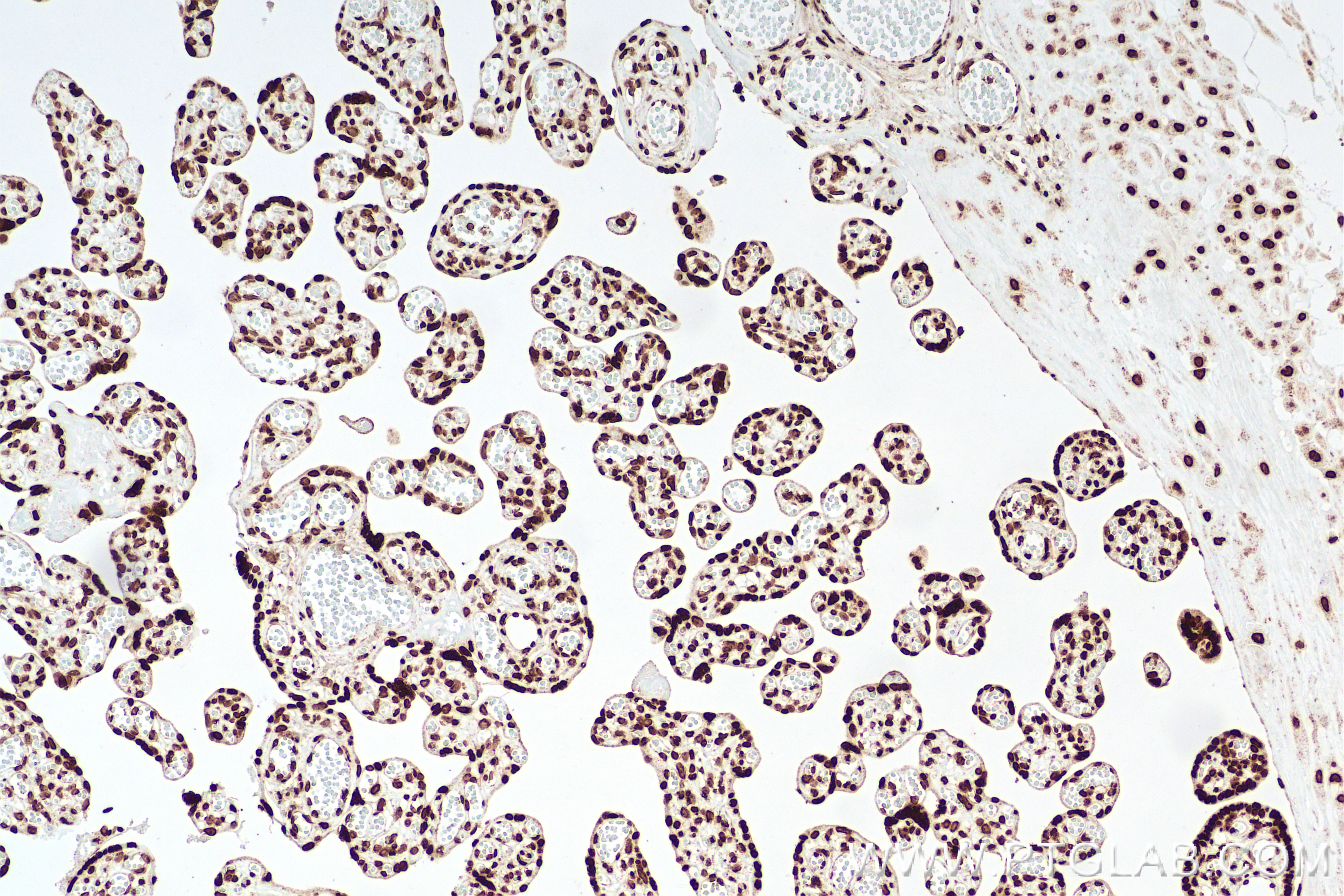 IHC staining of human placenta using 85854-1-RR