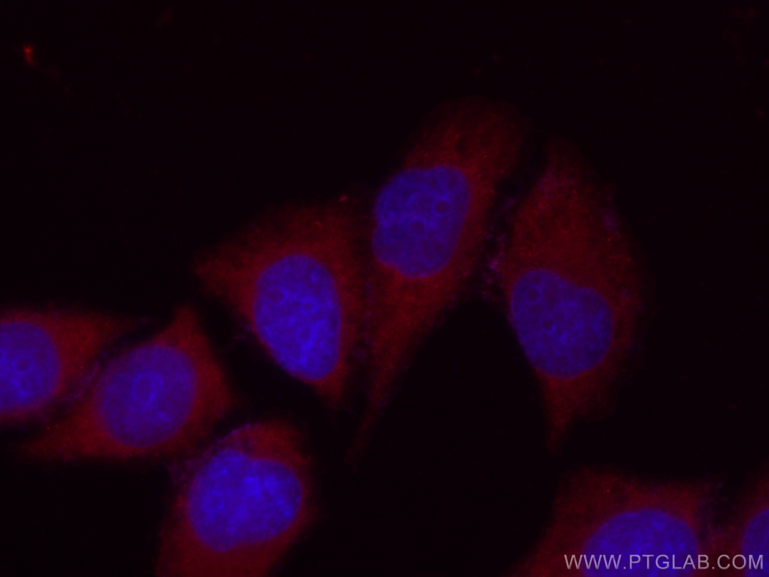 Apolipoprotein AI