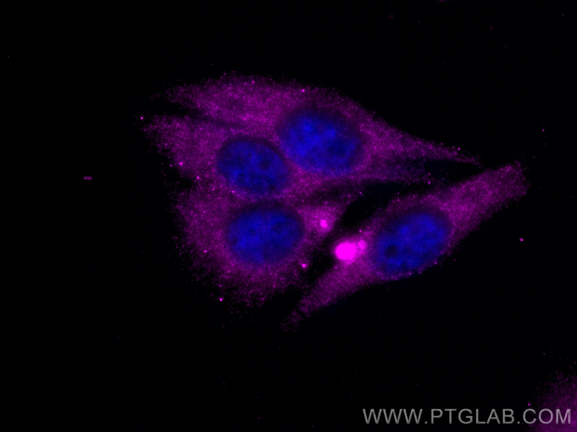 IF Staining of HepG2 using CL647-14427