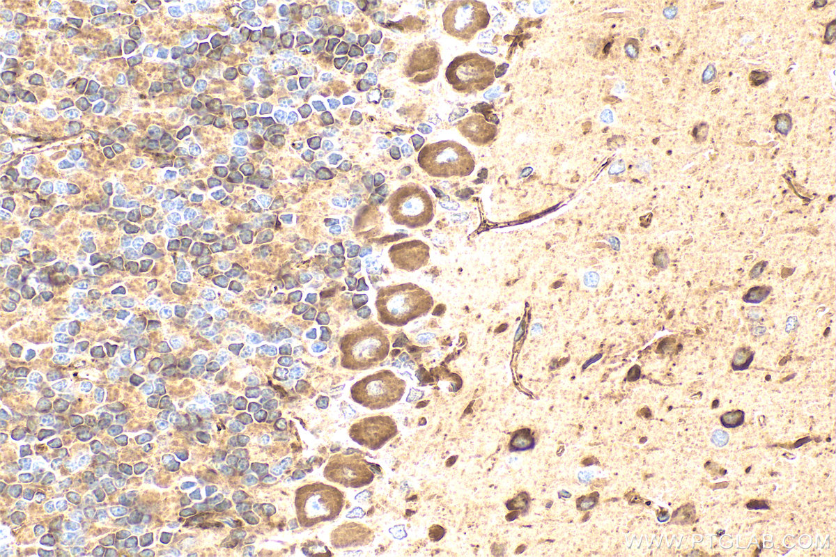 IHC staining of rat cerebellum using 31454-1-AP