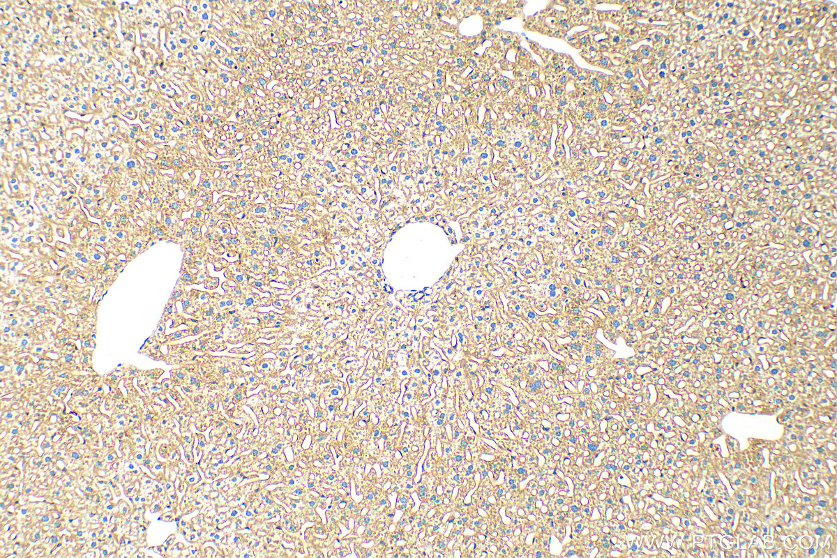 IHC staining of mouse liver using 83728-4-RR