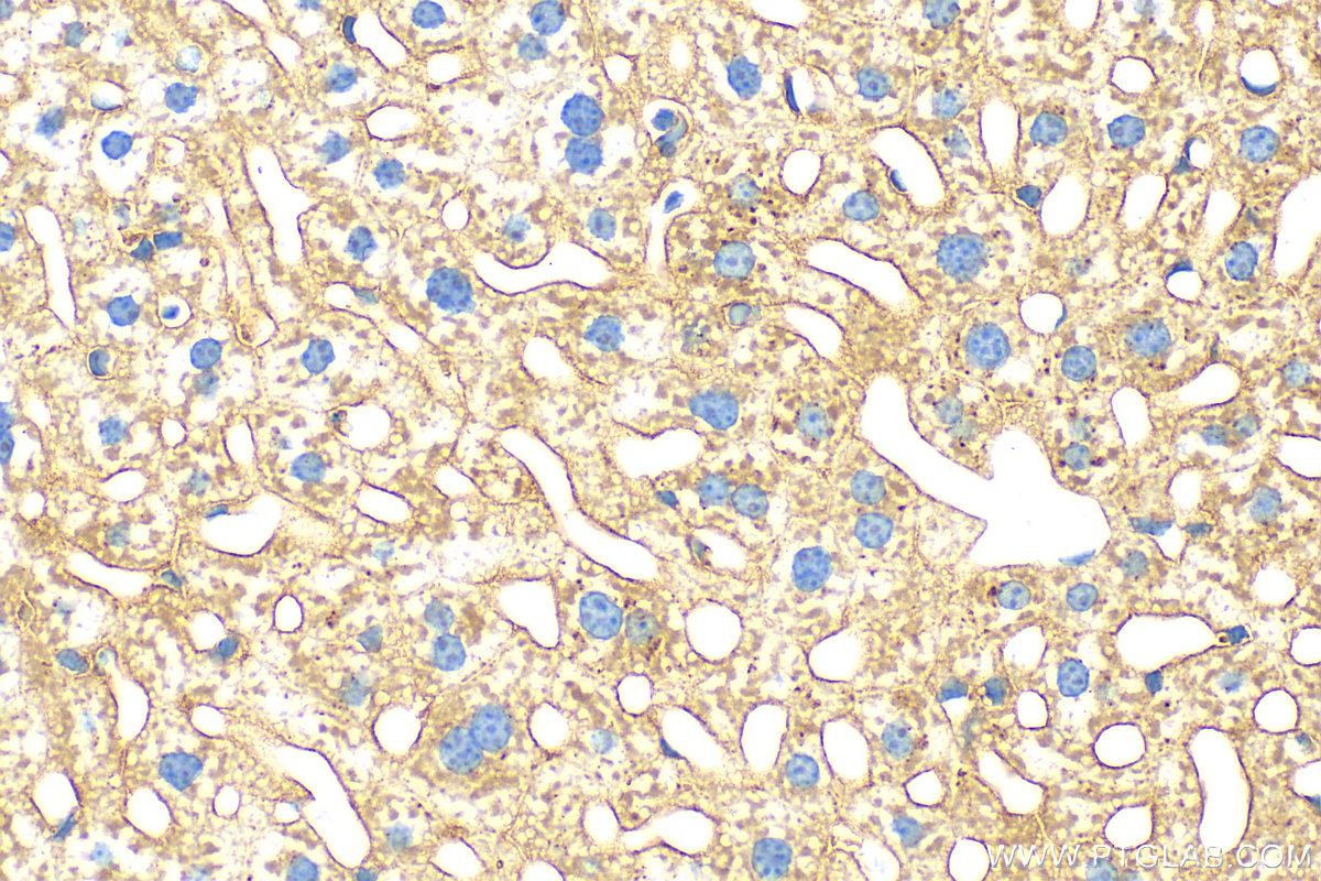 IHC staining of mouse liver using 83728-4-RR