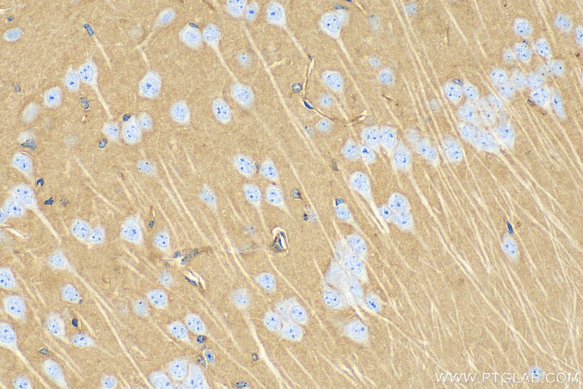 IHC staining of mouse brain using 83728-4-RR