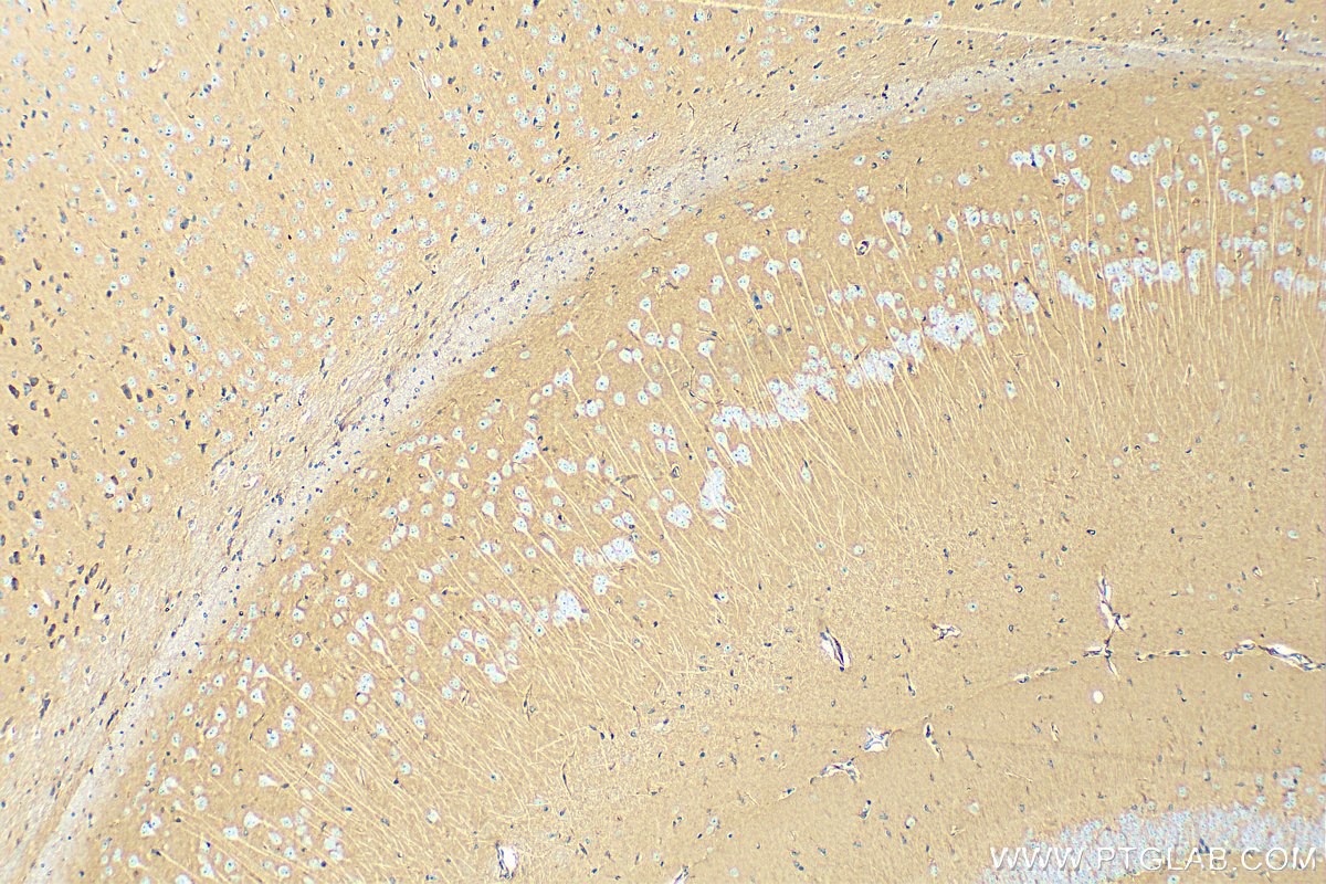 IHC staining of mouse brain using 83728-4-RR