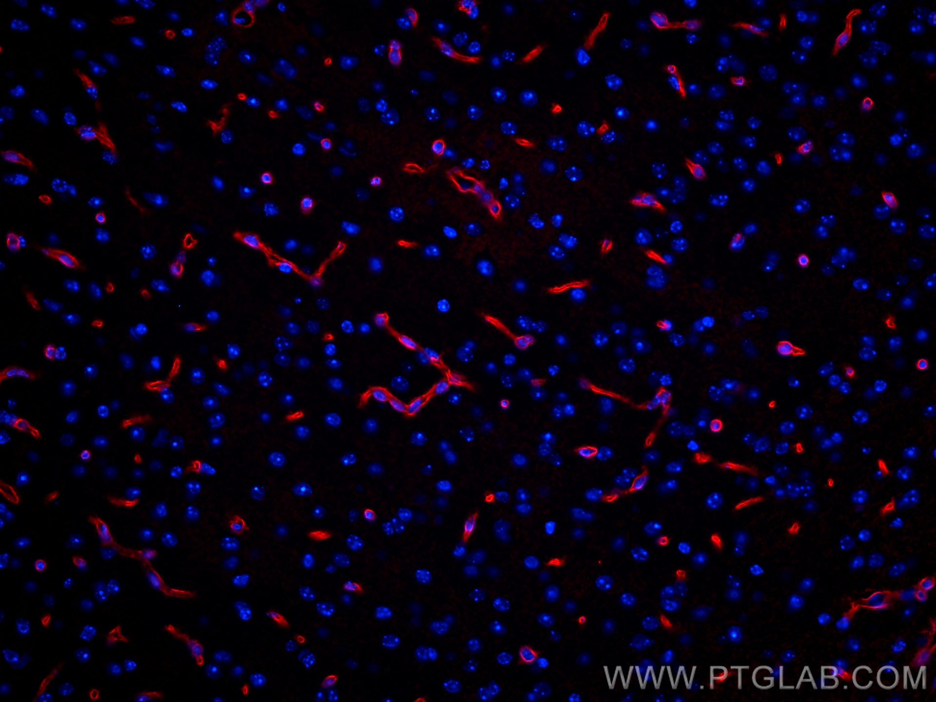 IF Staining of mouse brain using CL594-16473