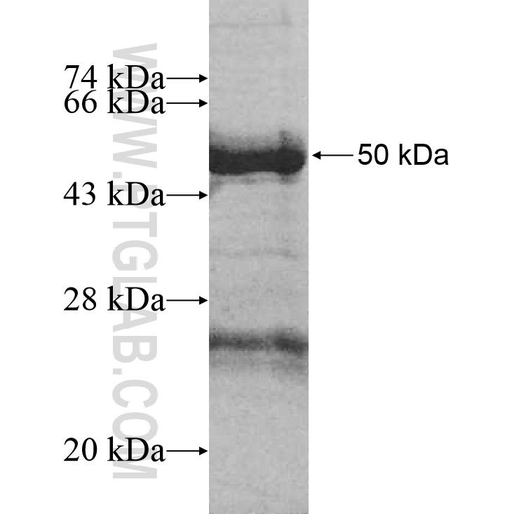 Ard1 fusion protein Ag11439 SDS-PAGE Ard1 fusion protein Ag11439 SDS-PAGE
