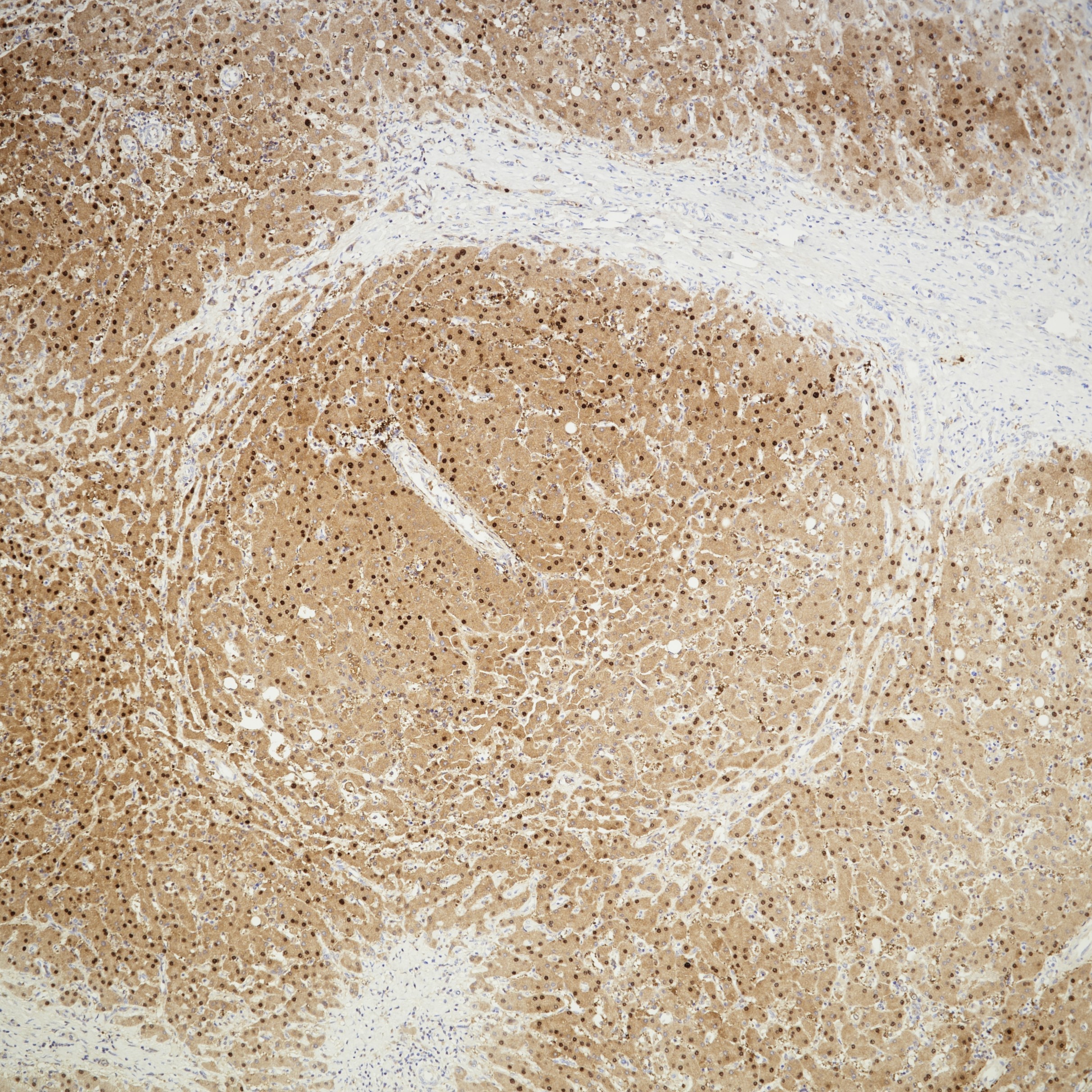 IHC staining of human liver using 82975-1-RR (same clone as 82975-1-PBS)