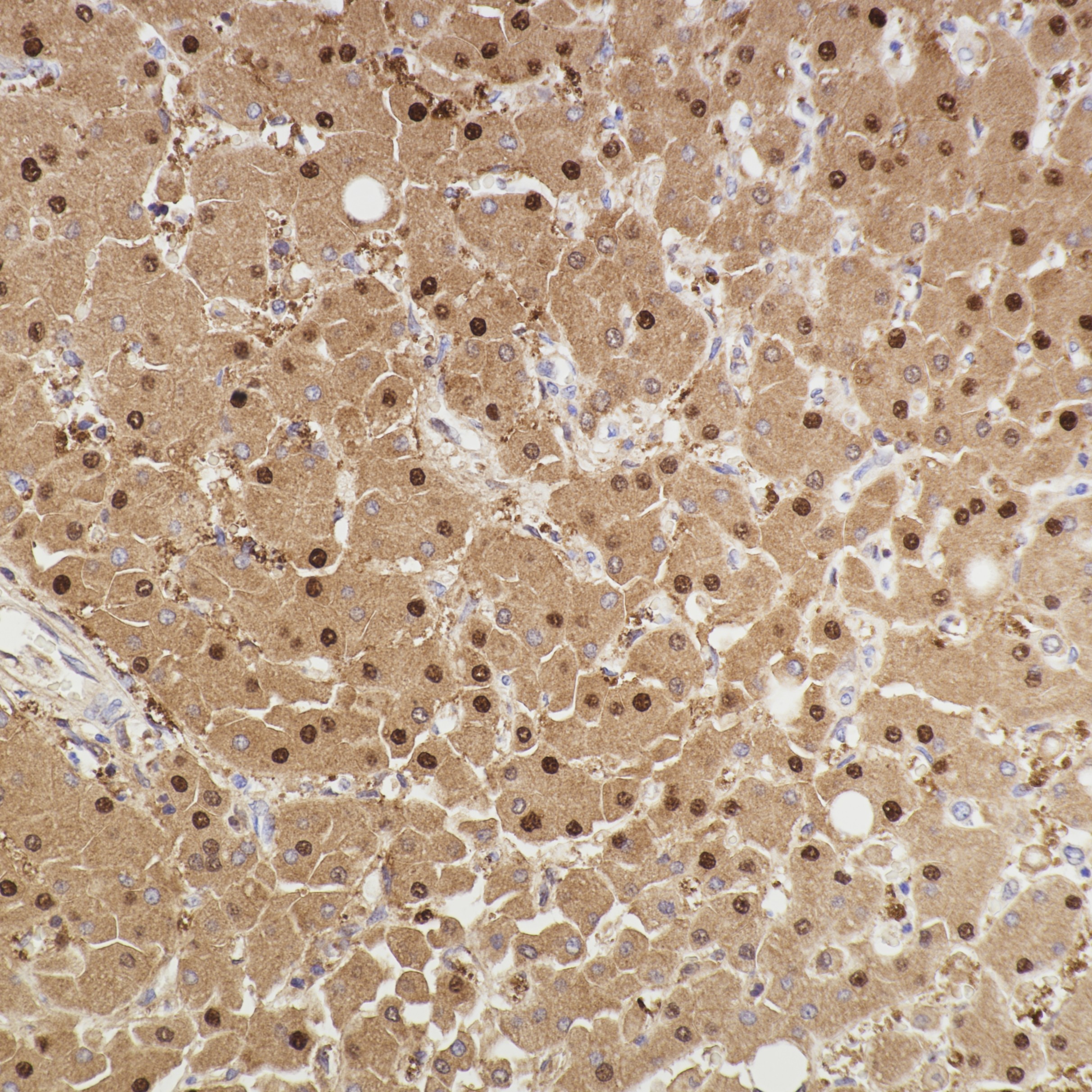 IHC staining of human liver using 82975-1-RR (same clone as 82975-1-PBS)