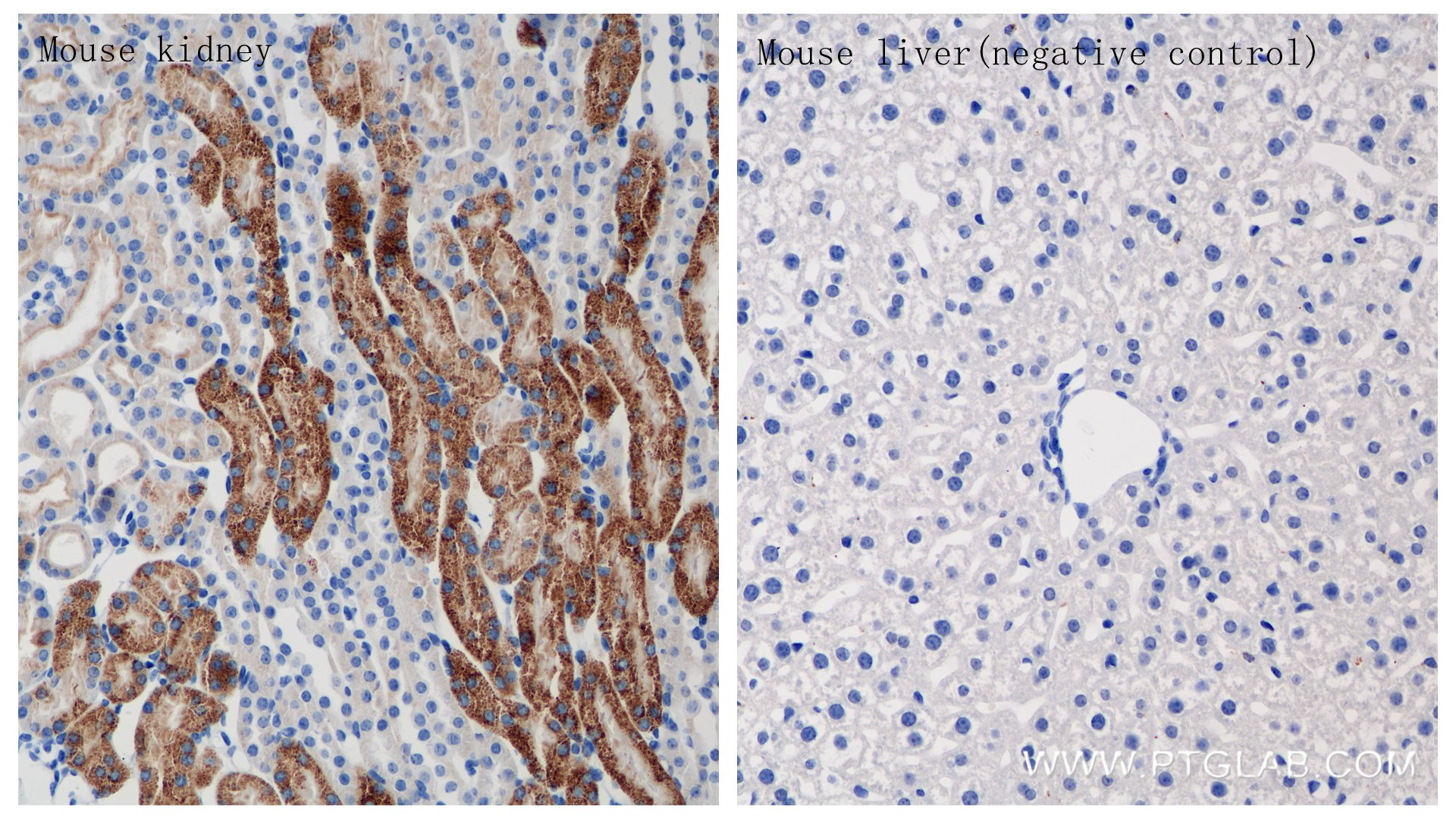 IHC staining of mouse kidney using 84808-5-RR
