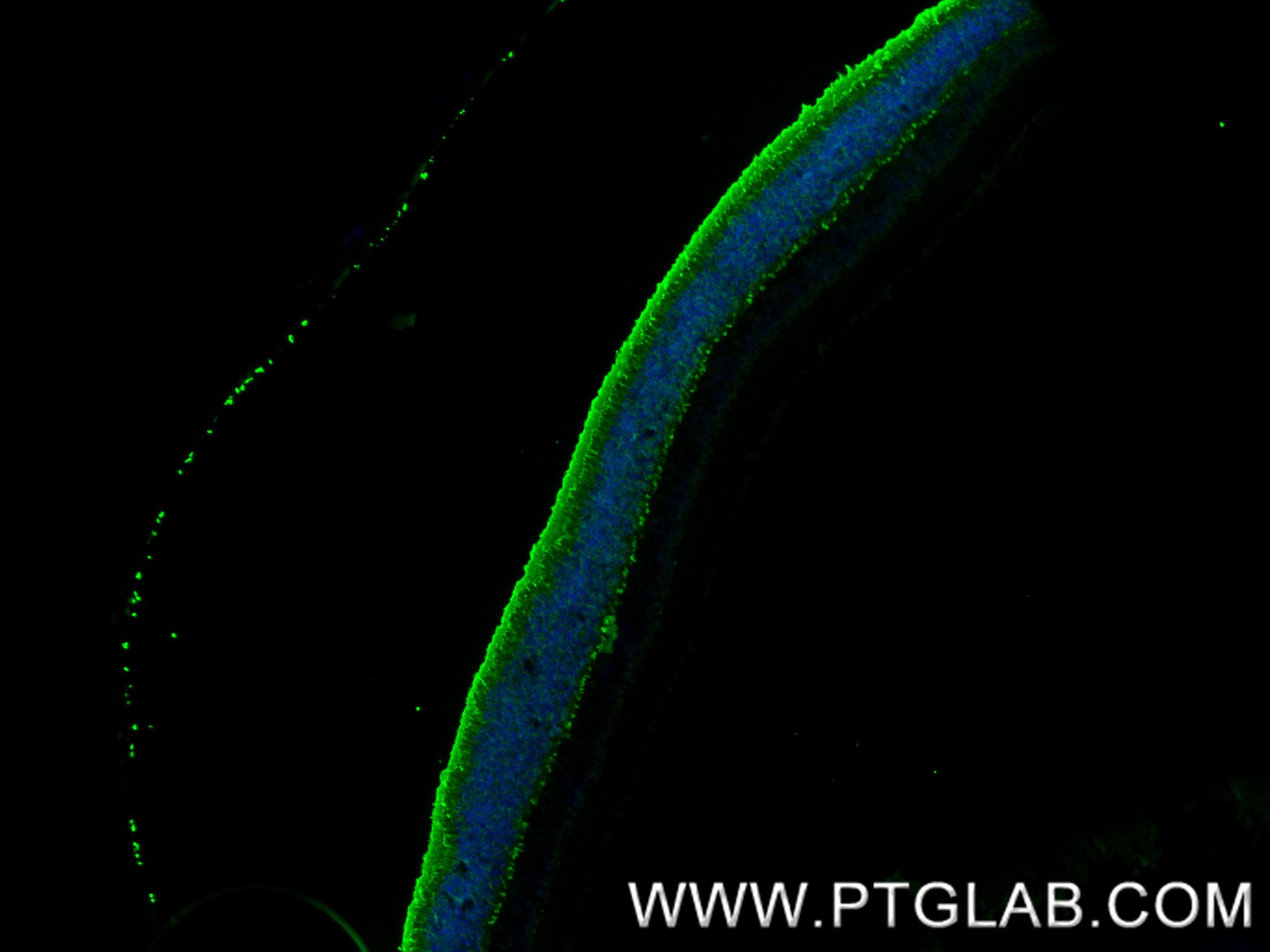 IF Staining of mouse eye using 85067-5-RR (same clone as 85067-5-PBS)