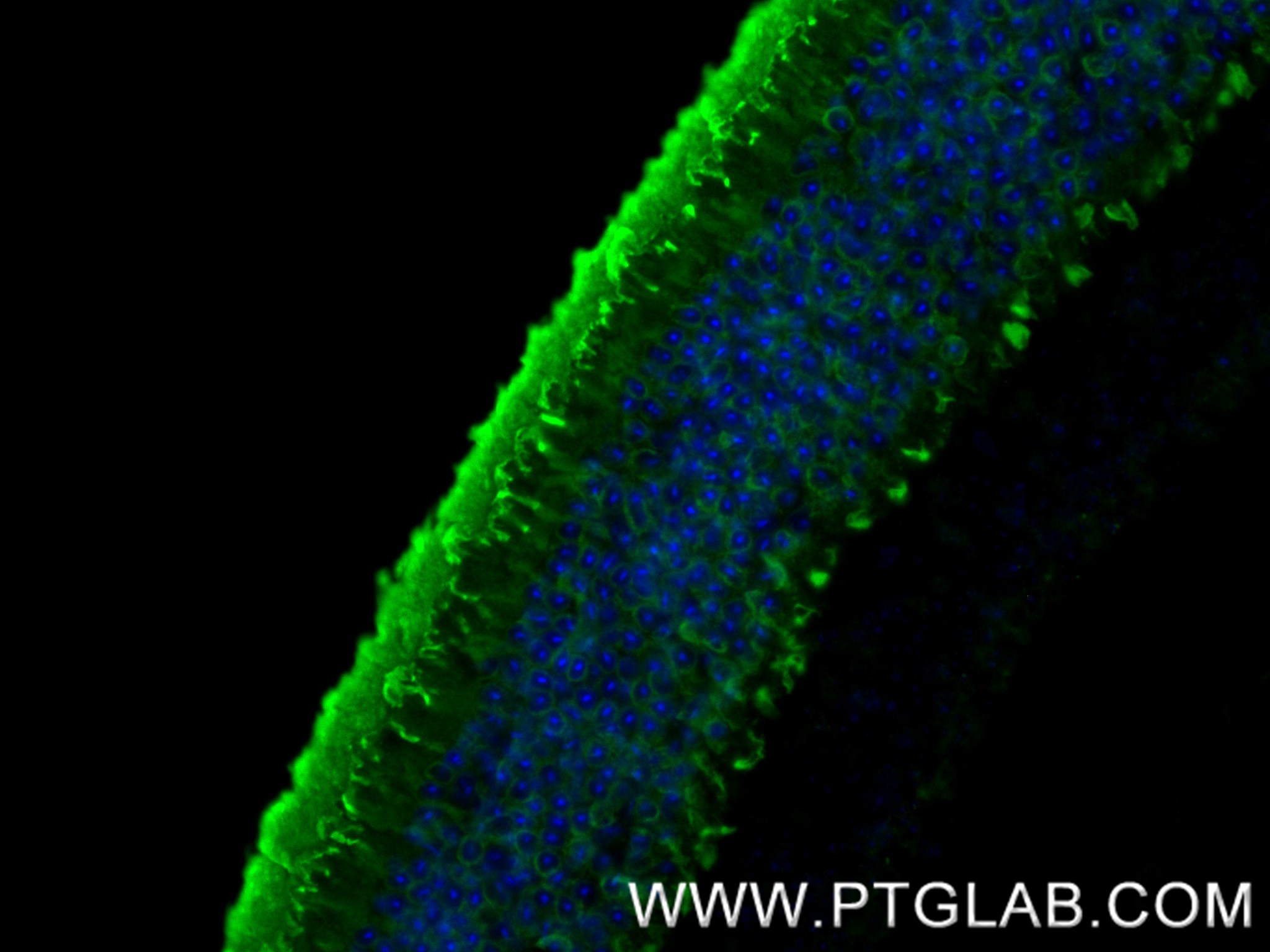 IF Staining of mouse eye using 85067-5-RR (same clone as 85067-5-PBS)