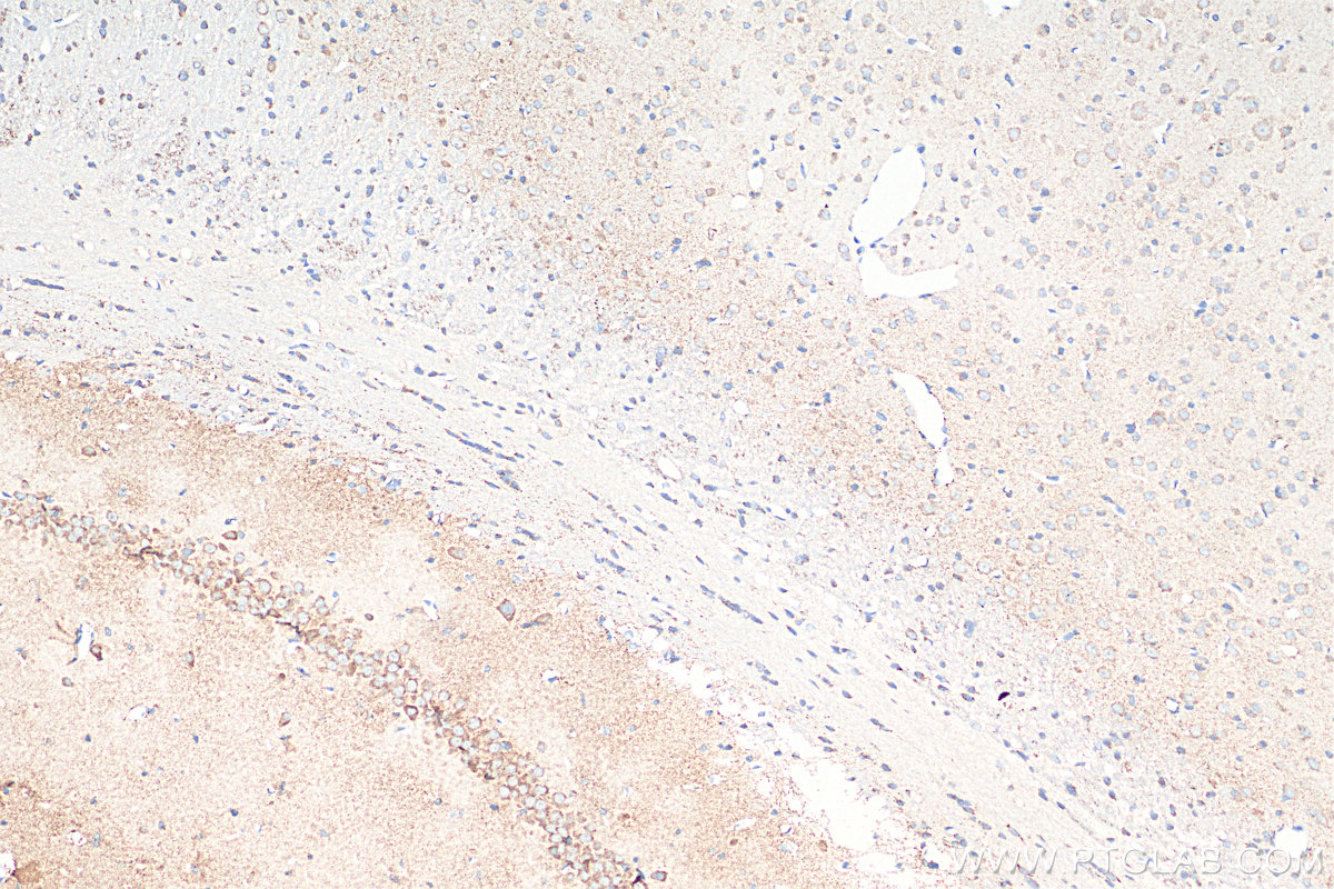 IHC staining of rat brain using 68316-1-Ig