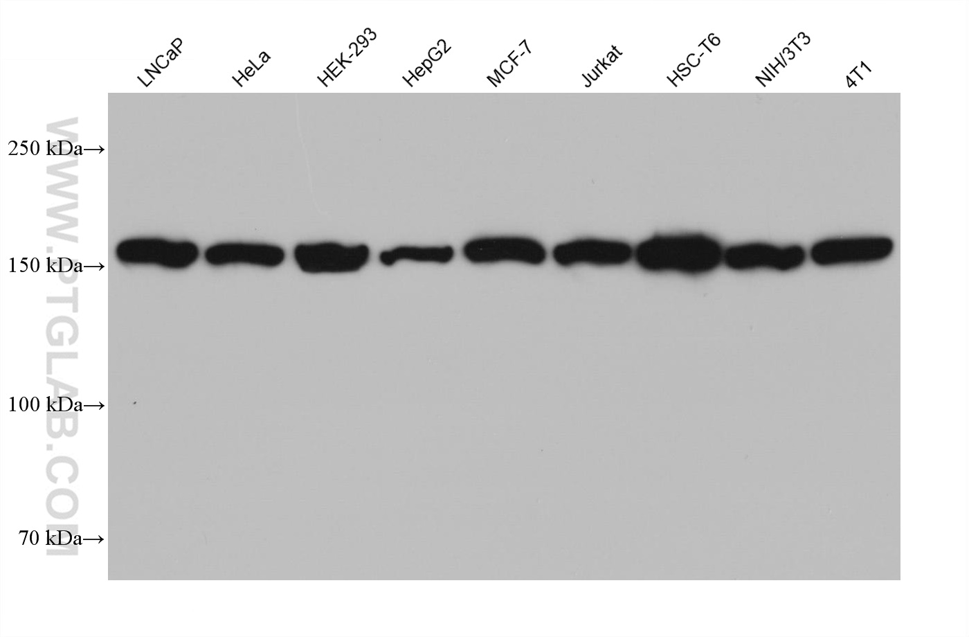 WB analysis using 68316-1-Ig