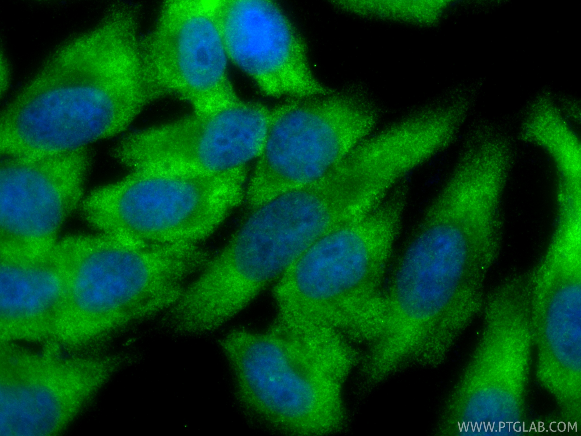 IF Staining of HepG2 using 80919-2-RR IF Staining of HepG2 using 80919-2-RR