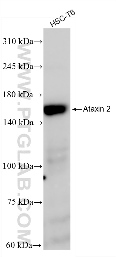 WB analysis of HSC-T6 using 80919-2-RR