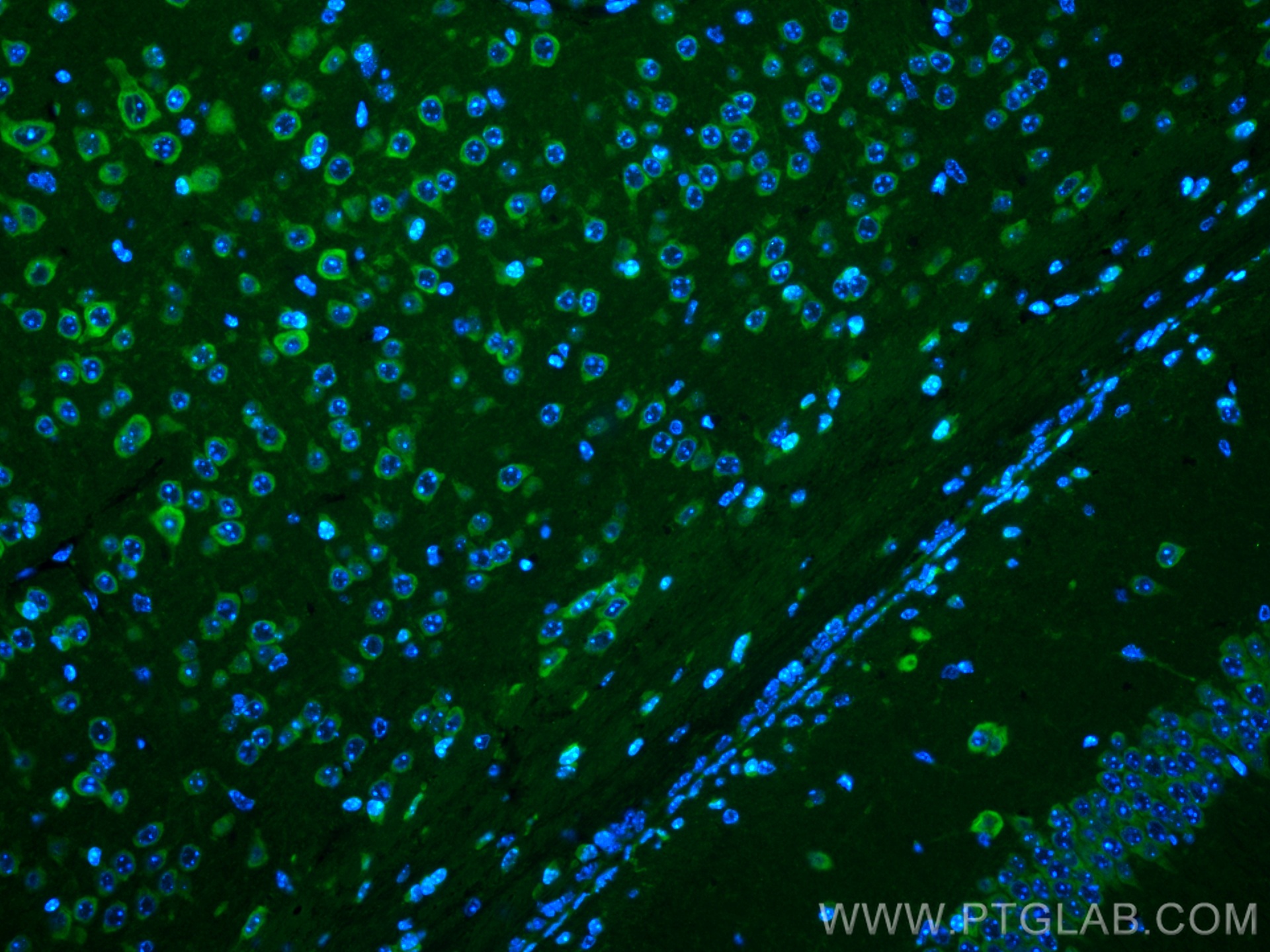 IF Staining of mouse brain using CL488-21776