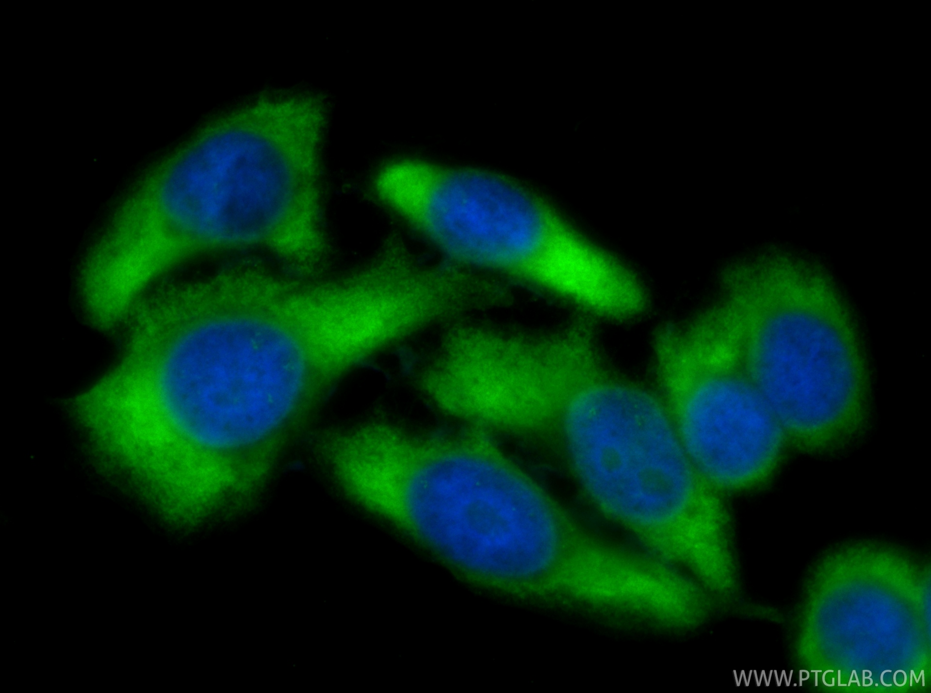 IF Staining of HepG2 using CL488-80919-2 IF Staining of HepG2 using CL488-80919-2