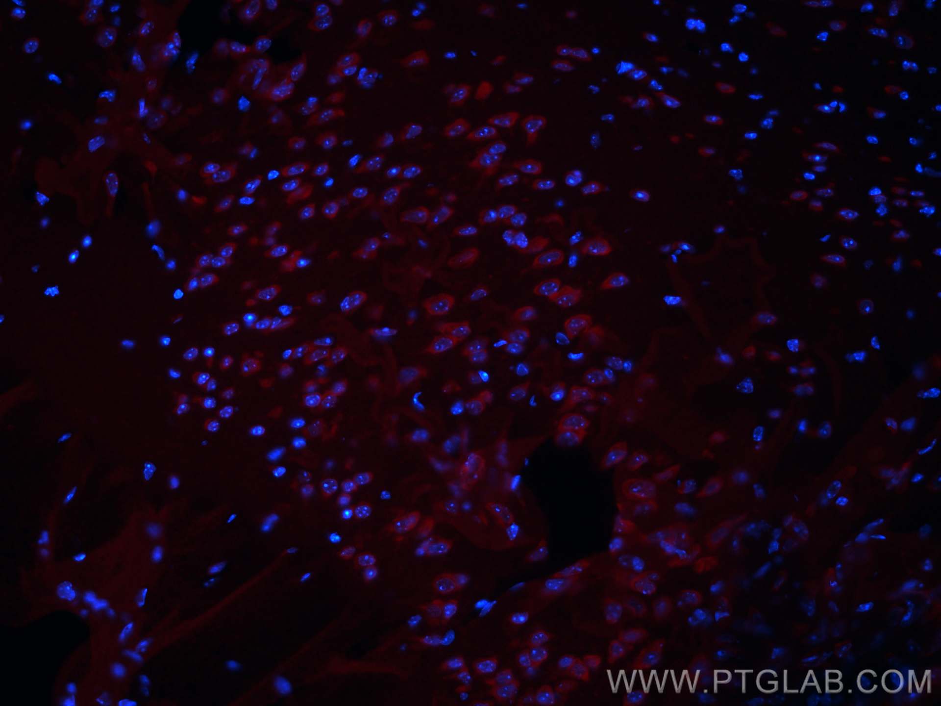 IF Staining of mouse brain using CL594-21776