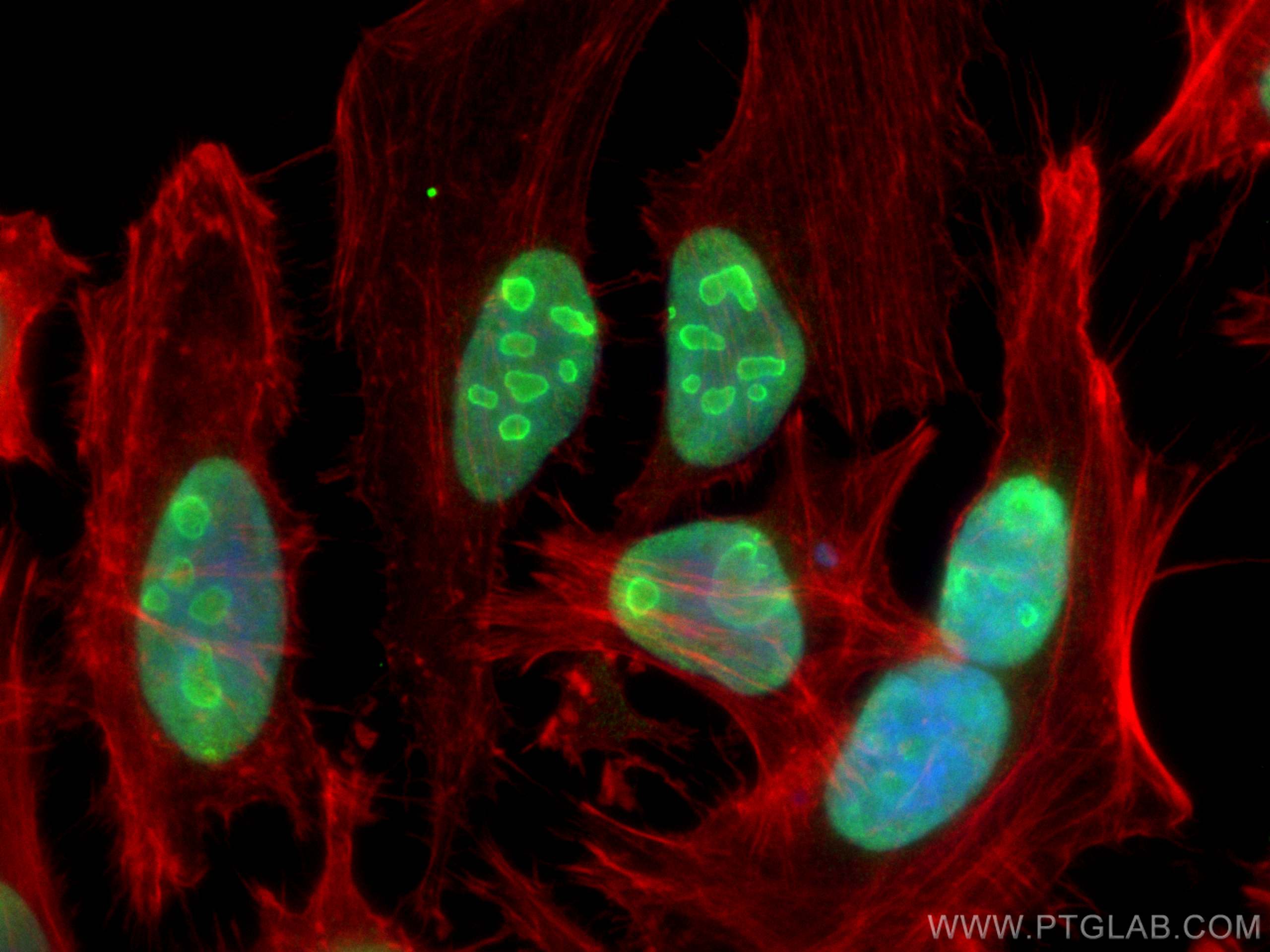 IF Staining of HeLa using 82030-1-RR (same clone as 82030-1-PBS)
