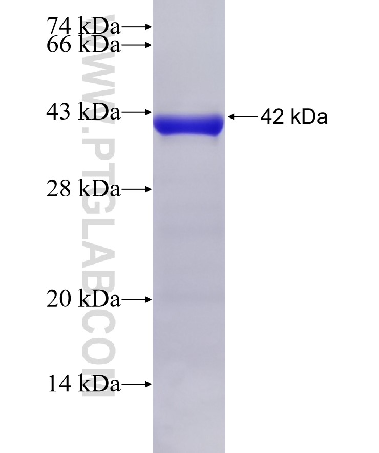 B23 fusion protein Ag7415 SDS-PAGE