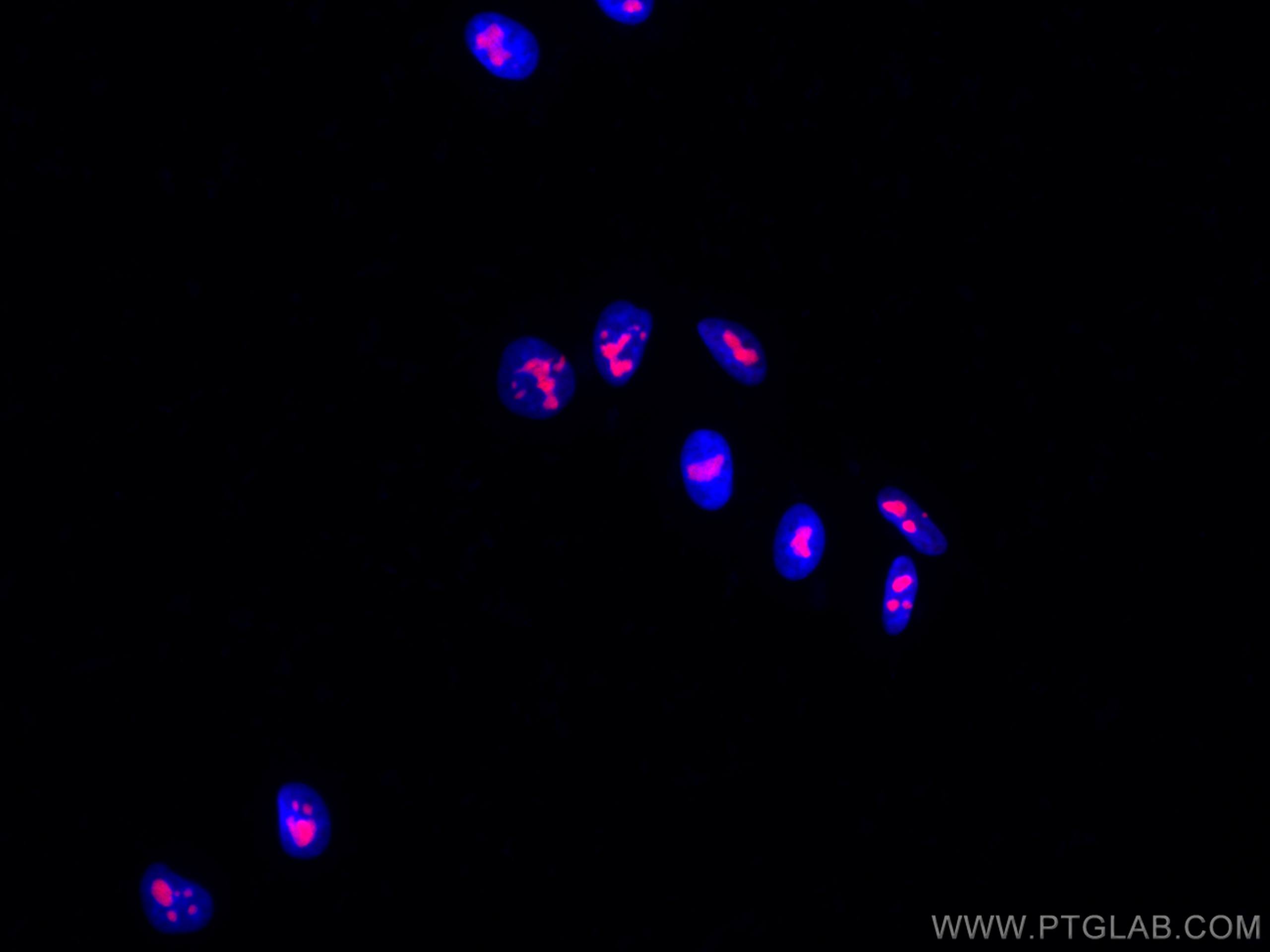 IF Staining of HepG2 using CL555-60096