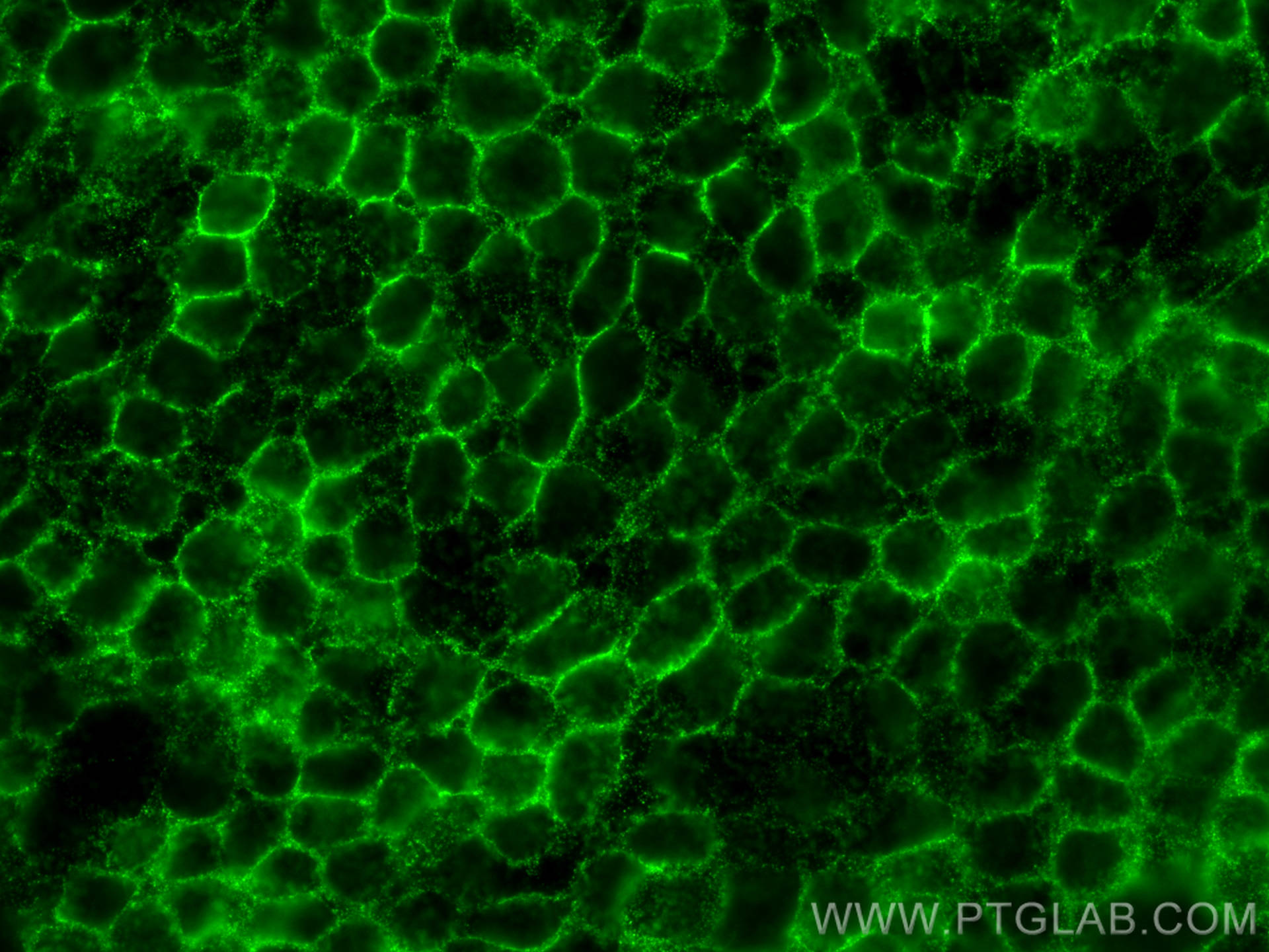 IF Staining of A431 using 13511-1-AP