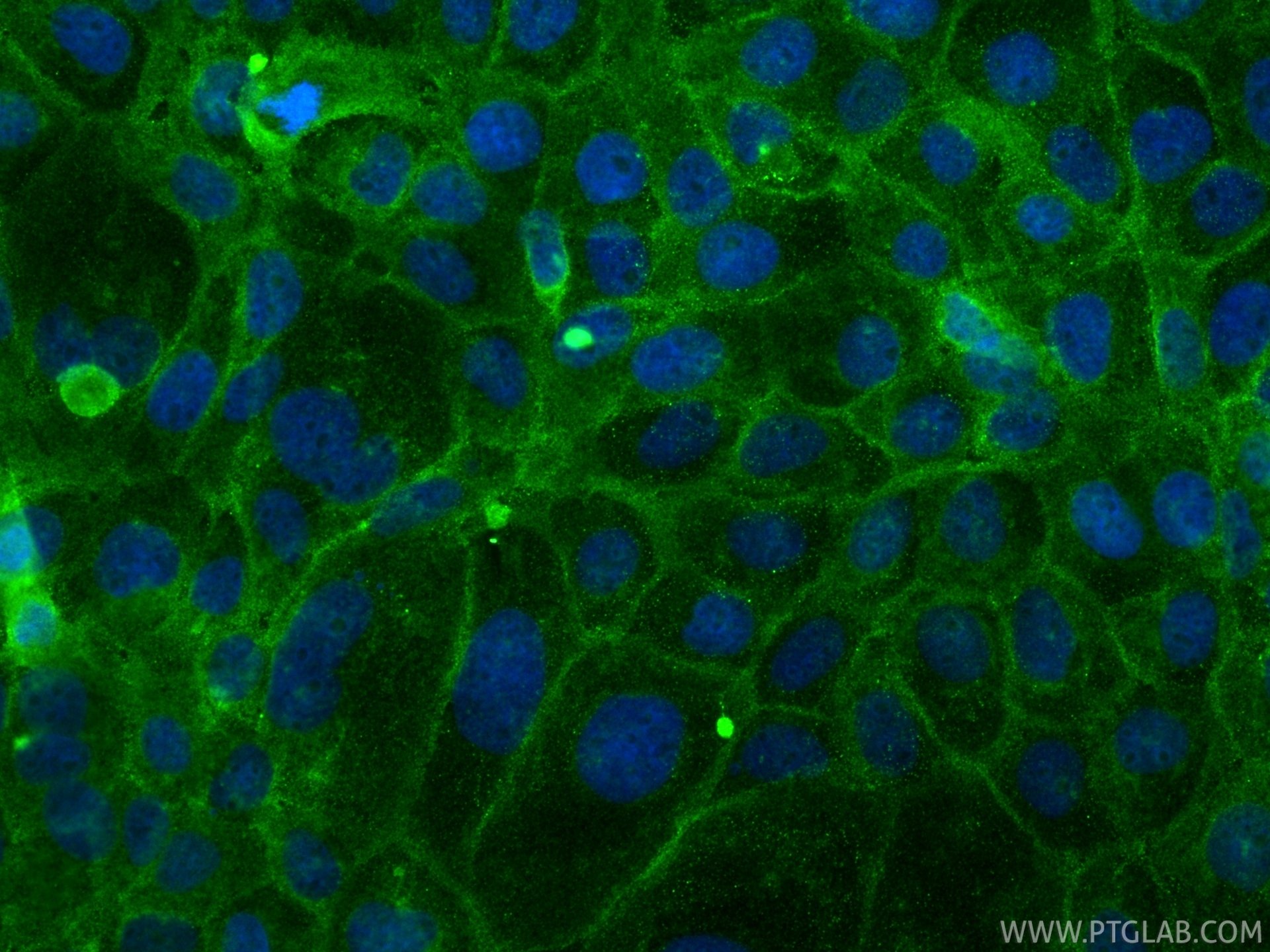 IF Staining of A431 using 13511-1-AP