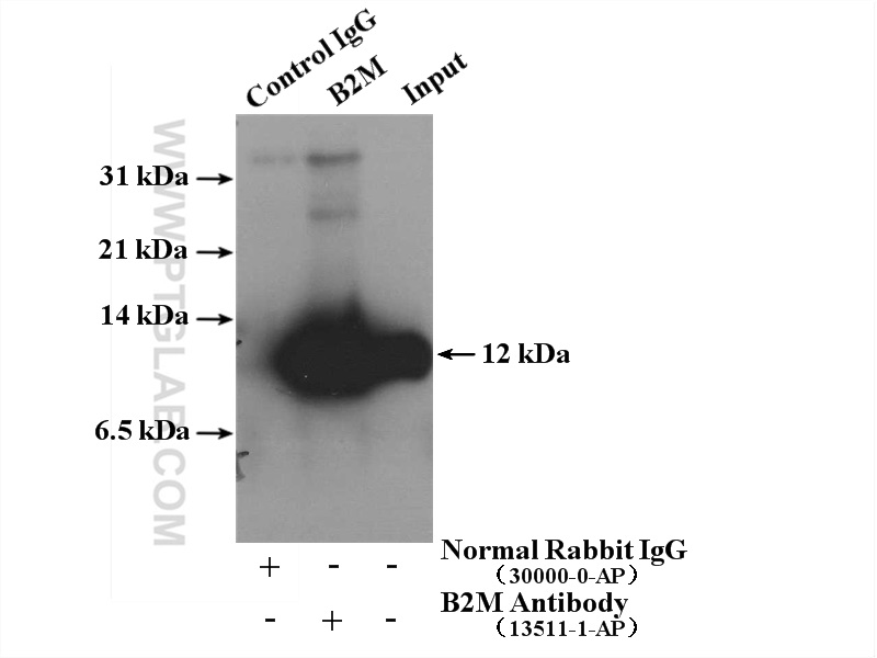 IP experiment of A431 using 13511-1-AP