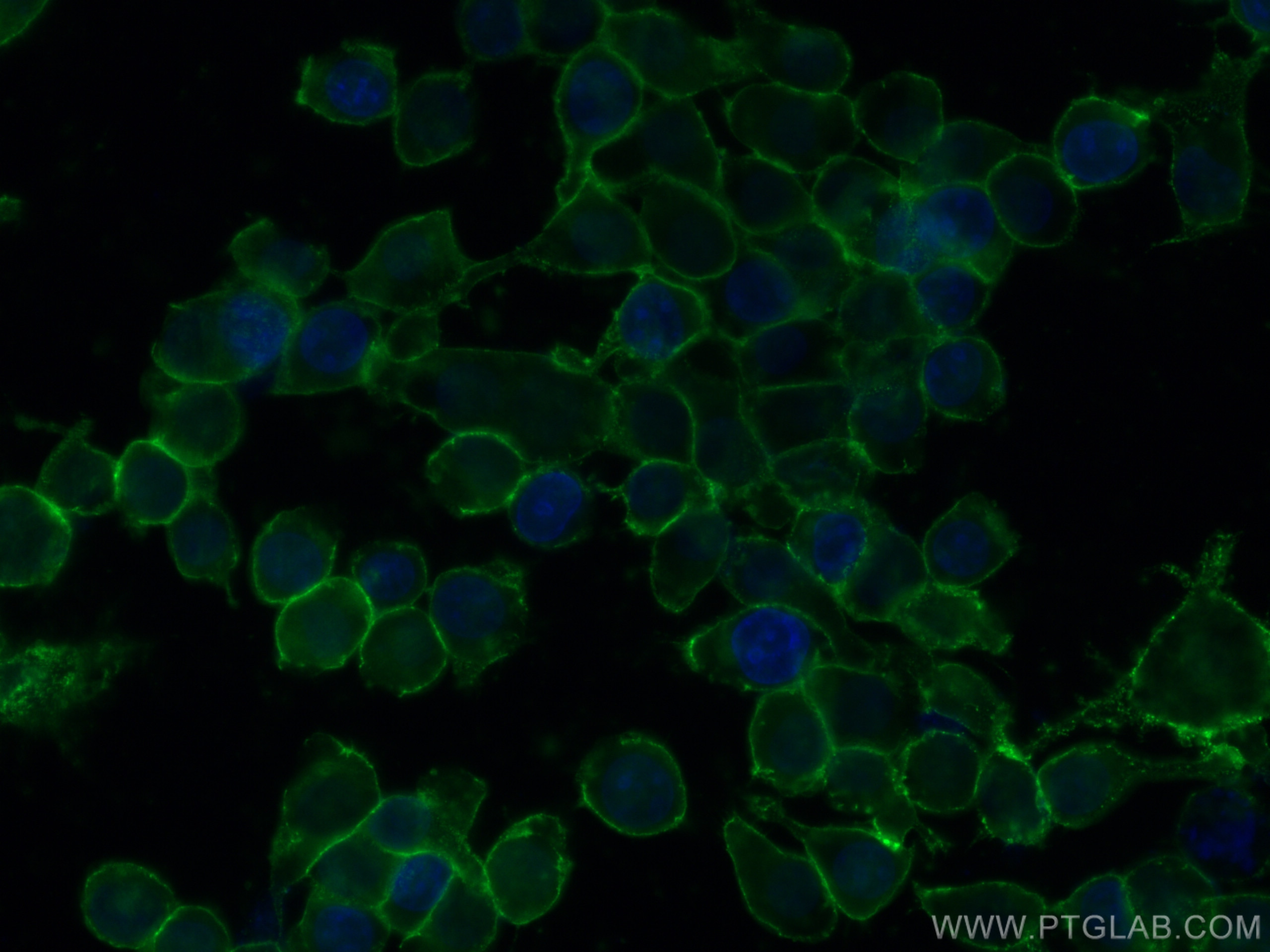 Beta-2-Microglobulin