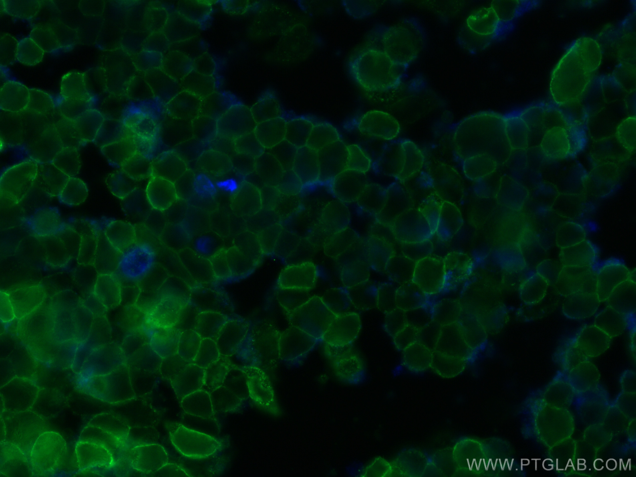 IF Staining of NCCIT using 68395-1-Ig (same clone as 68395-1-PBS)