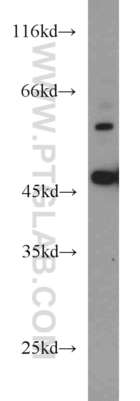 WB analysis of HEK-293 using 17142-1-AP