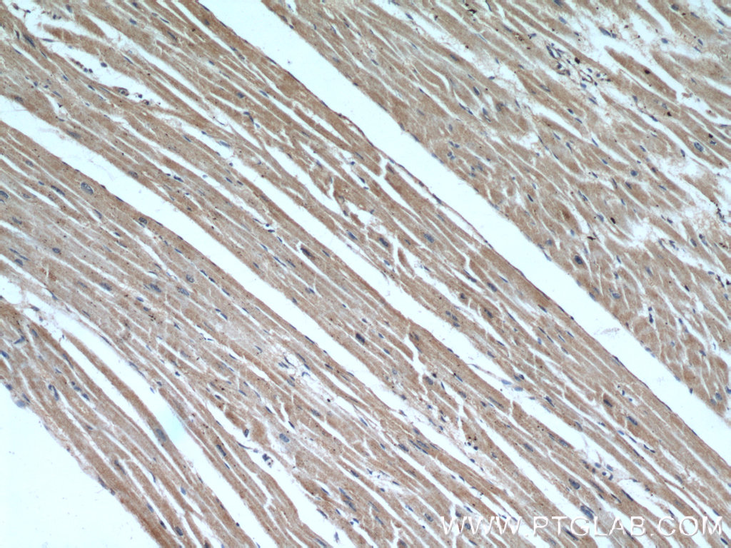 IHC staining of human heart using 14177-1-AP