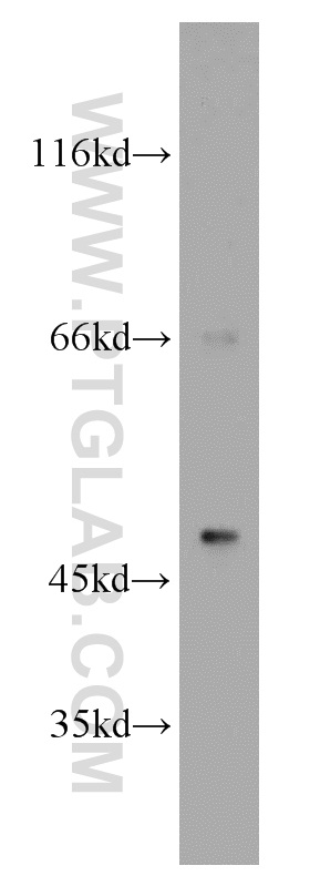 WB analysis of mouse brain using 14177-1-AP