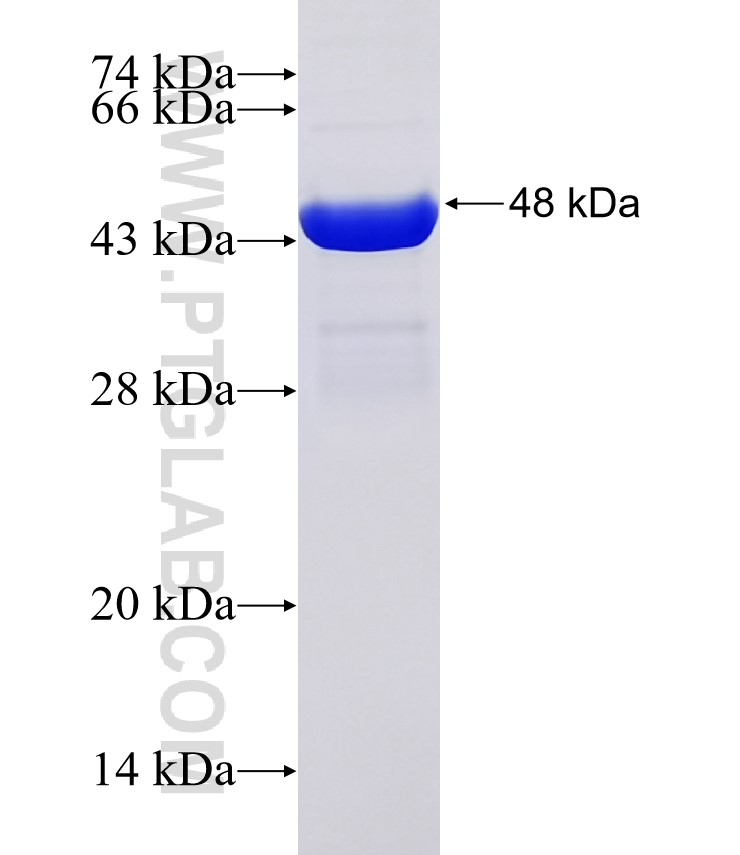 B3GALT4 fusion protein Ag31515 SDS-PAGE B3GALT4 fusion protein Ag31515 SDS-PAGE