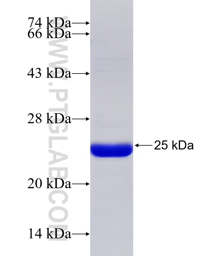 B3GALT4 fusion protein Ag31524 SDS-PAGE